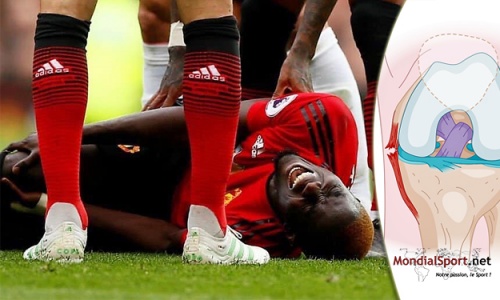 Eric Bailly / Déchirure du ligament collatéral : De quoi s’agit-il ? Comment se déroule le traitement ?