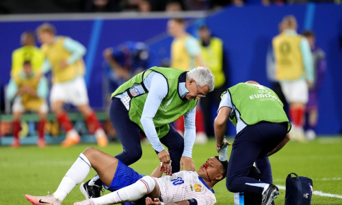 Euro 2024 : Kylian Mbappé annoncé forfait face aux Pays-Bas