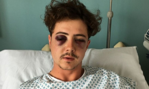 Insolite : un fan de Tottenham tabassé par des supporters de sa propre équipe