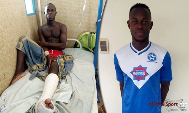 Jambe fracturée, Tra Romaric (Bouaké FC) raconte son accident à moto